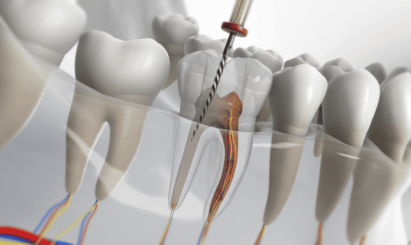 Dental emergency at Advanced Family Cosmetic Dentistry
